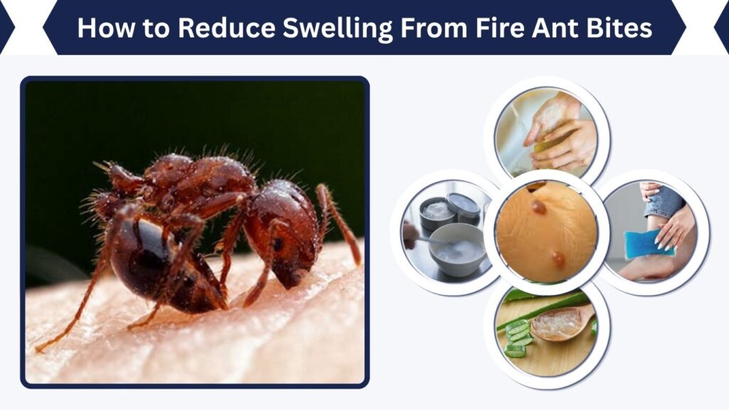 How to Reduce Swelling From Fire Ant Bites