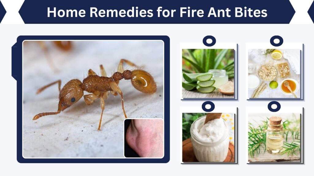 Home Remedies for Fire Ant Bites
