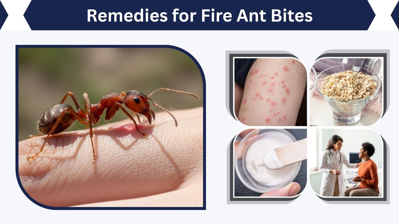 Remedies for Fire Ant Bites: Treatment, Prevention & Care Tips