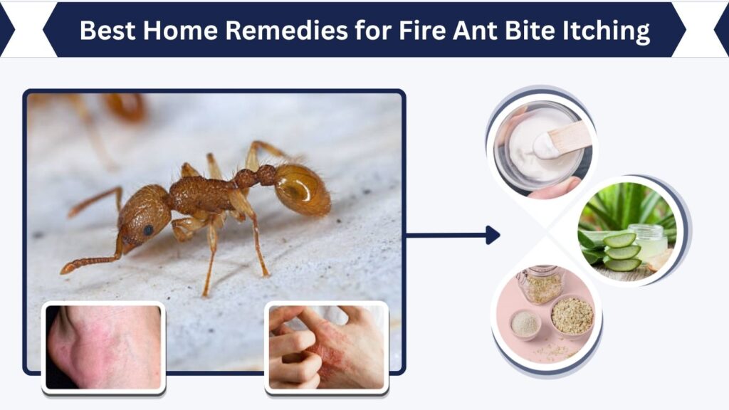 Best Home Remedies for Fire Ant Bite Itching