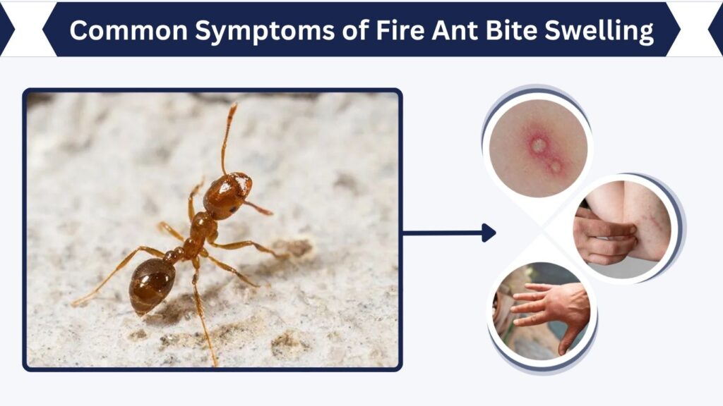 Common Symptoms of Fire Ant Bite Swelling