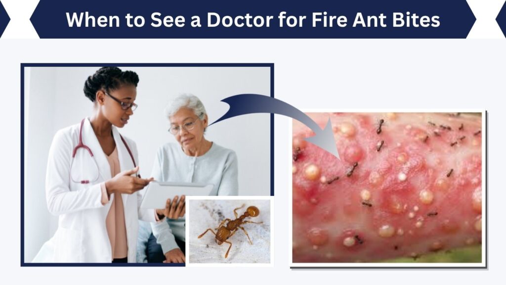 When to See a Doctor for Fire Ant Bites