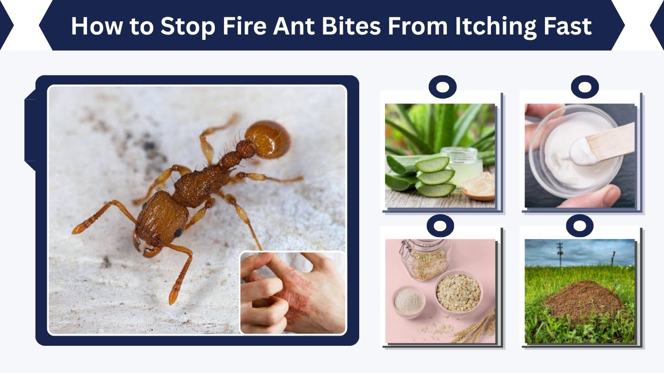 How to Stop Fire Ant Bites From Itching Fast