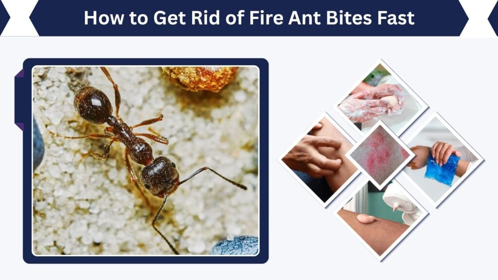 How to Get Rid of Fire Ant Bites Fast