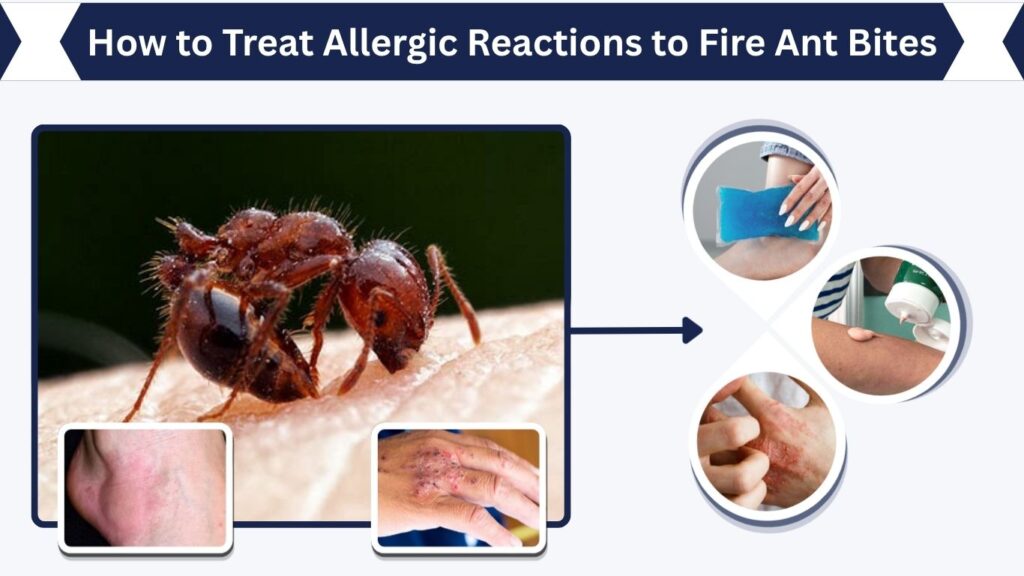 How to Treat Allergic Reactions to Fire Ant Bites