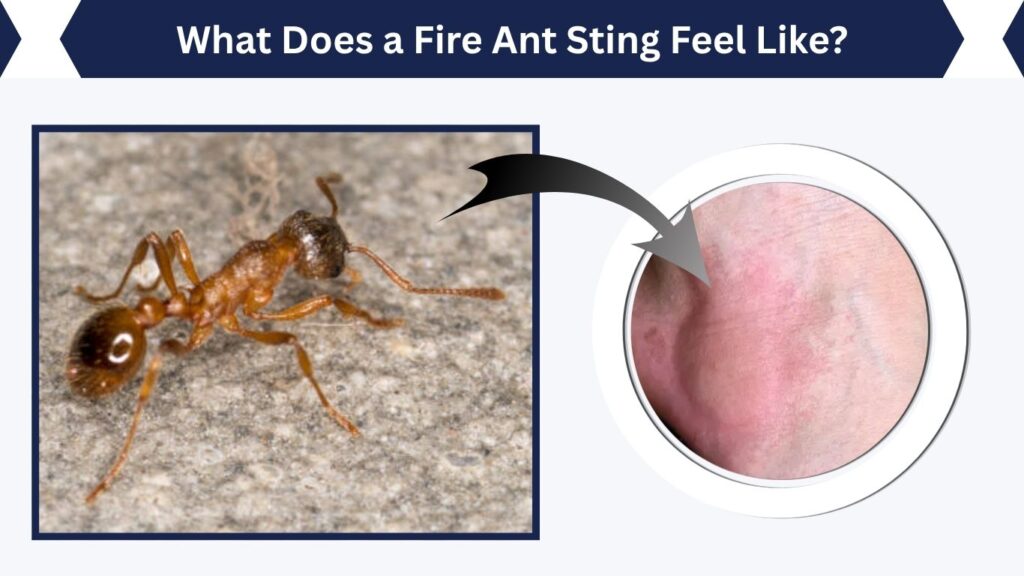 What Does a Fire Ant Sting Feel Like?