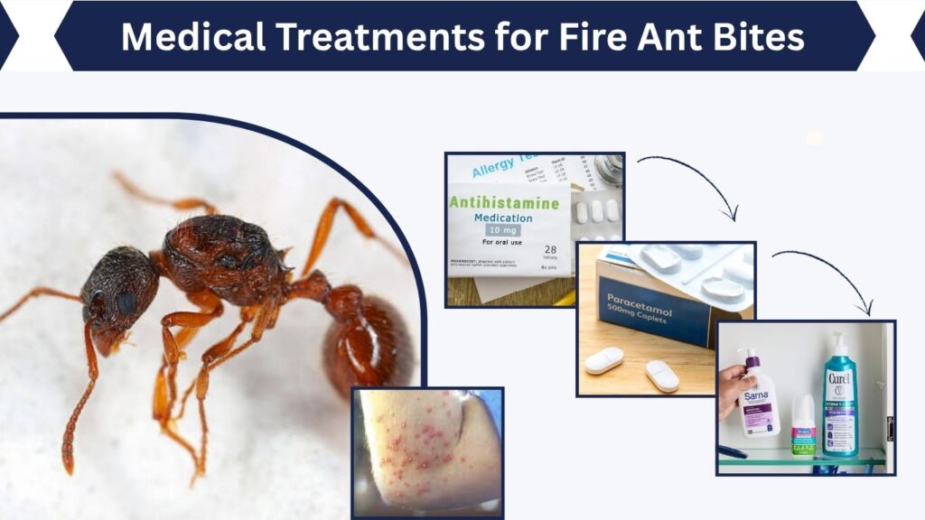 Medical Treatments for Fire Ant Bites