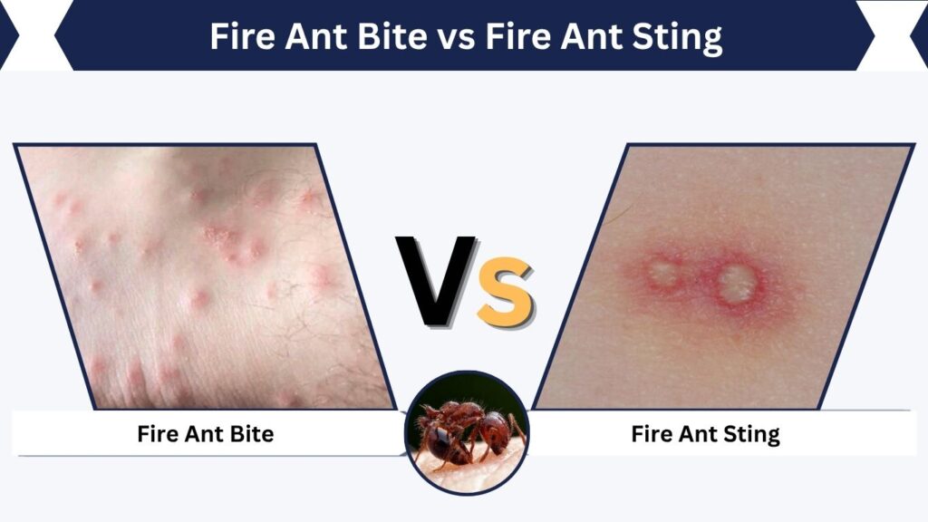 Fire Ant Bite vs Fire Ant Sting