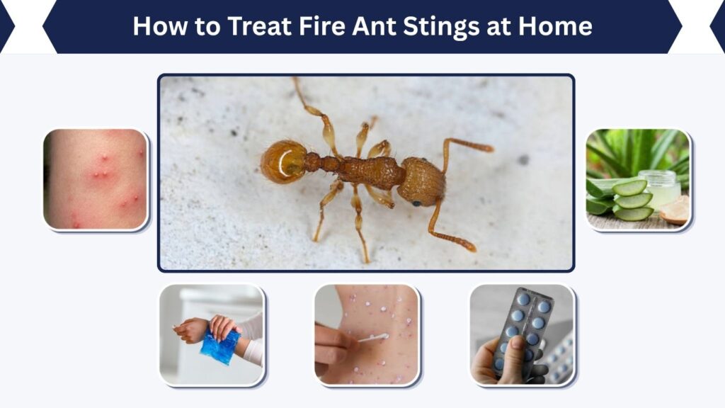 How to Treat Fire Ant Stings at Home