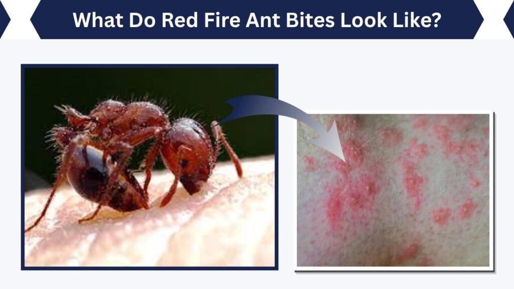 What Do Red Fire Ant Bites Look Like?