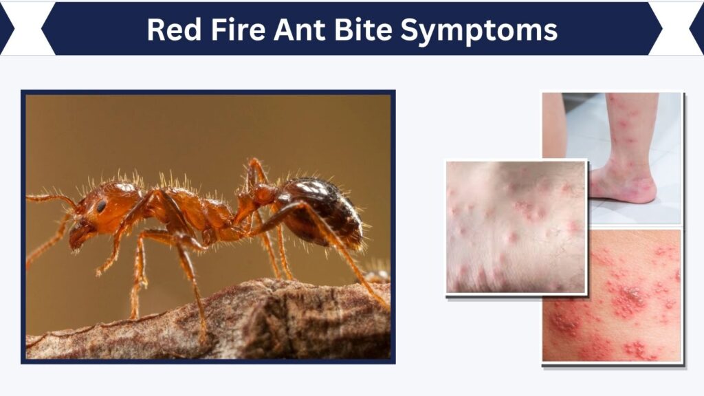 Red Fire Ant Bite Symptoms