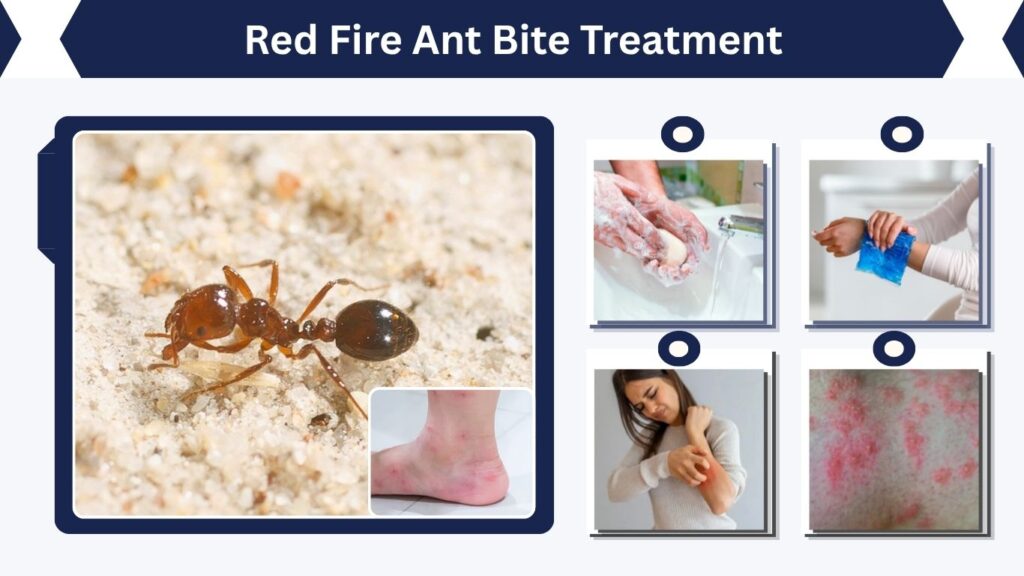 Red Fire Ant Bite Treatment