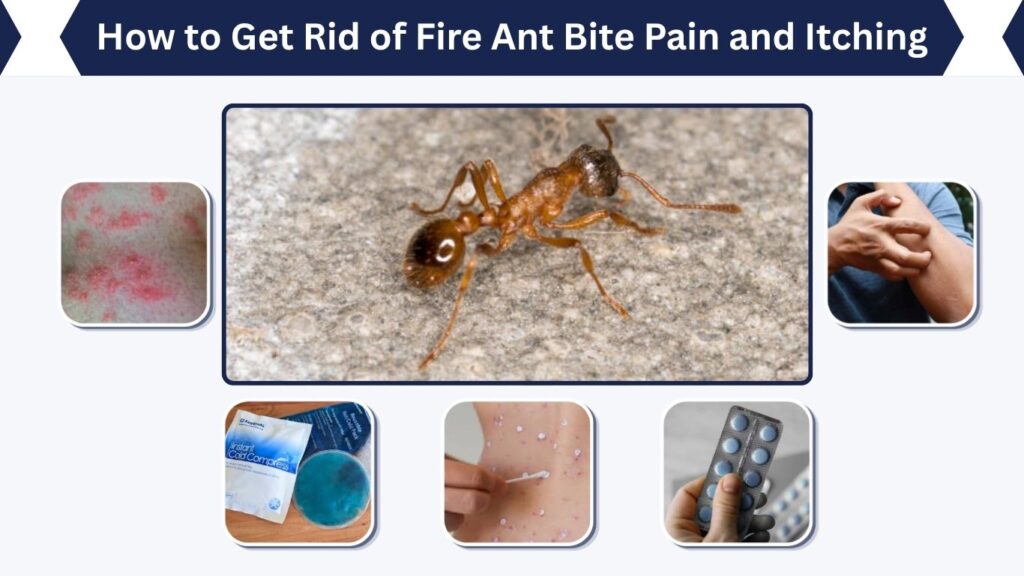 How to Get Rid of Fire Ant Bite Pain and Itching