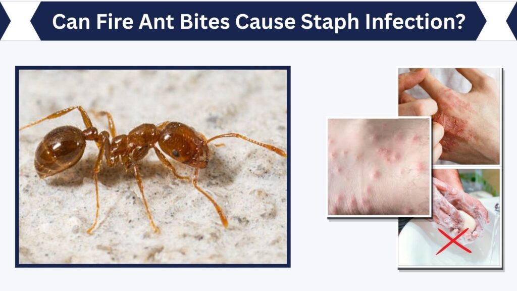 Open pustules collect bacteria