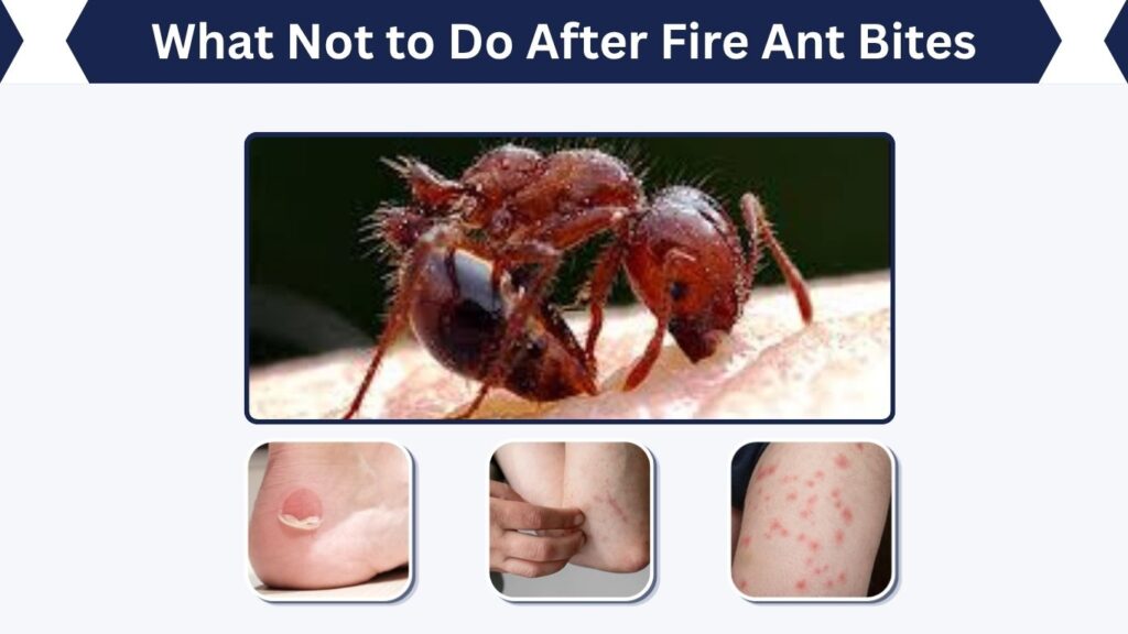 What Not to Do After Fire Ant Bites