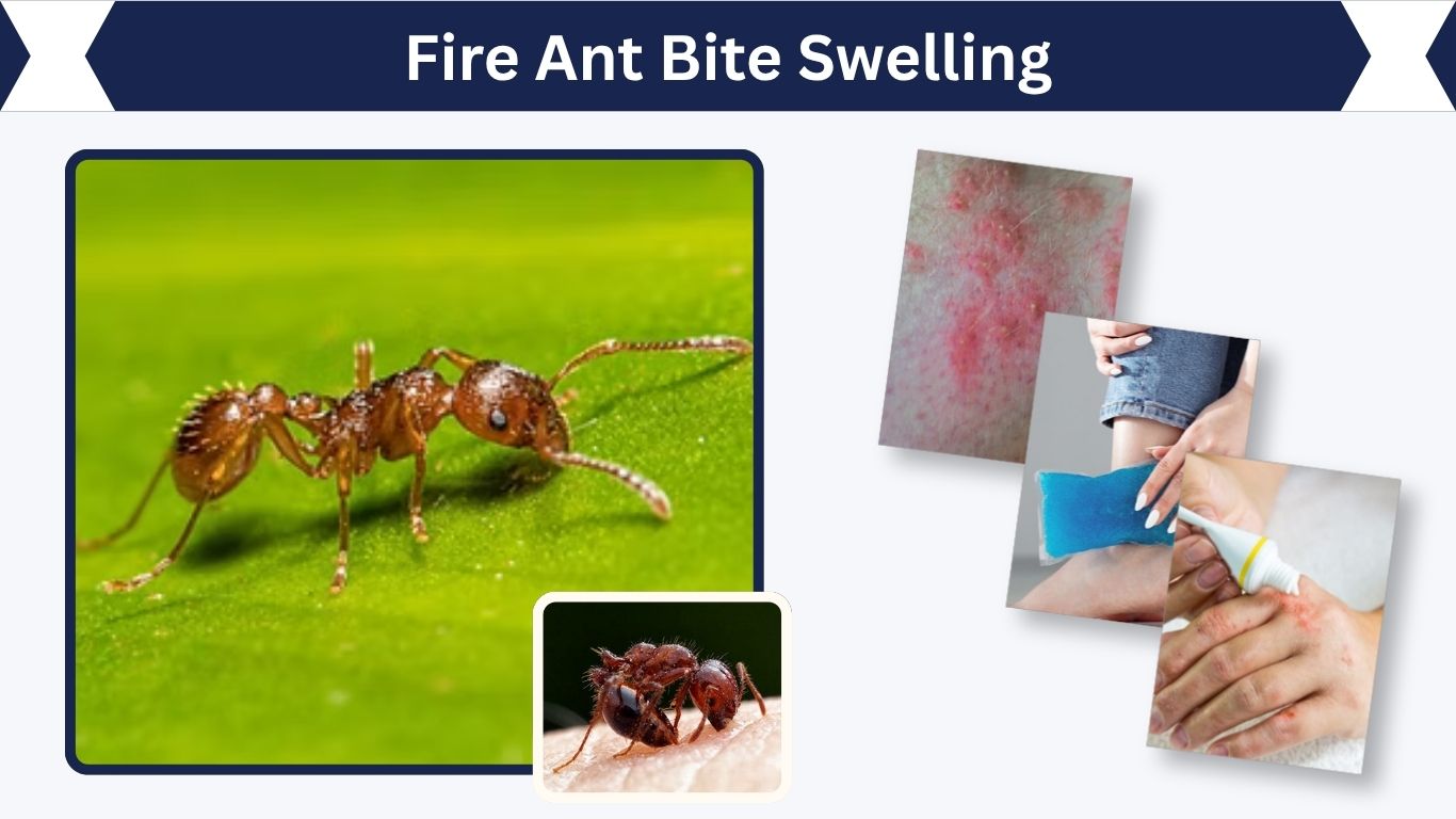 Fire Ant Bite Swelling: Causes, Symptoms and Remedies
