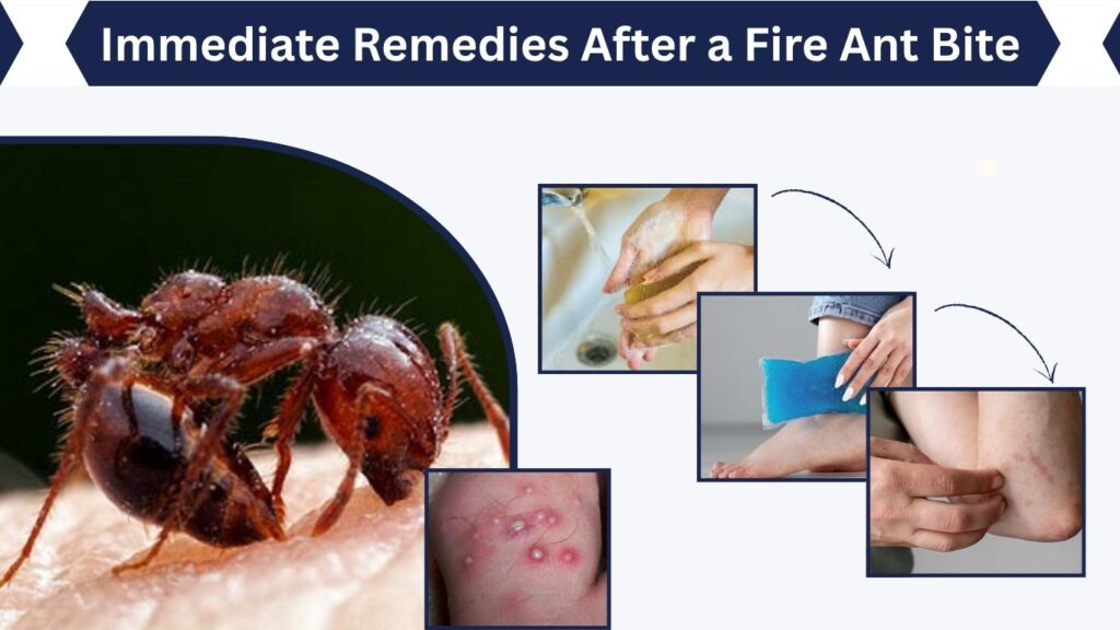 Immediate Remedies After a Fire Ant Bite