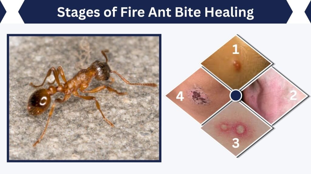 Stages of Fire Ant Bite Healing