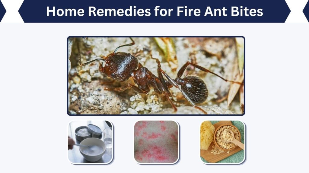 Home Remedies for Fire Ant Bites