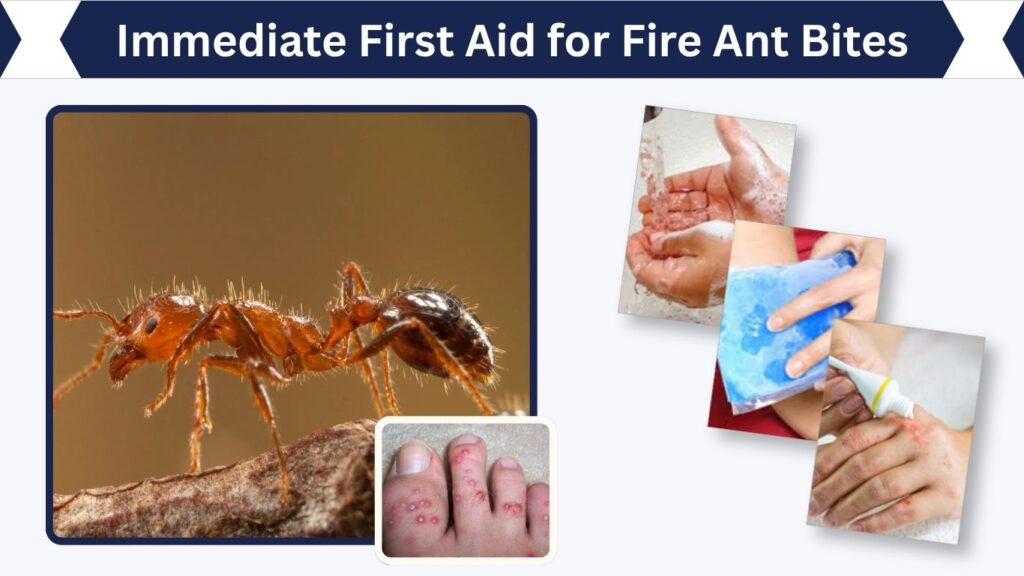 Immediate First Aid for Fire Ant Bites