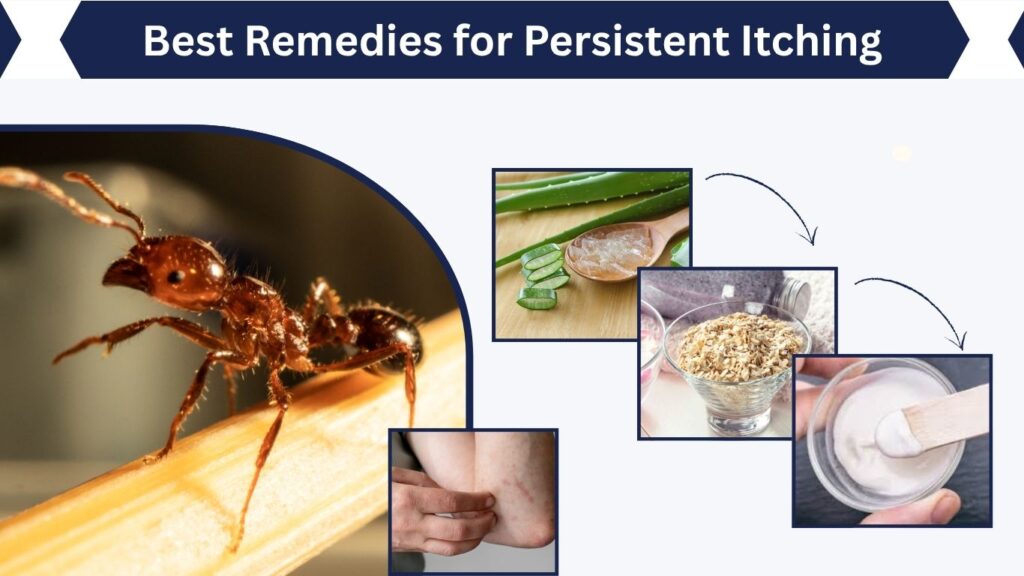 Best Remedies for Persistent Itching