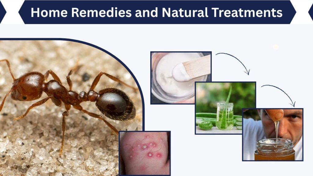 Home Remedies and Natural Treatments