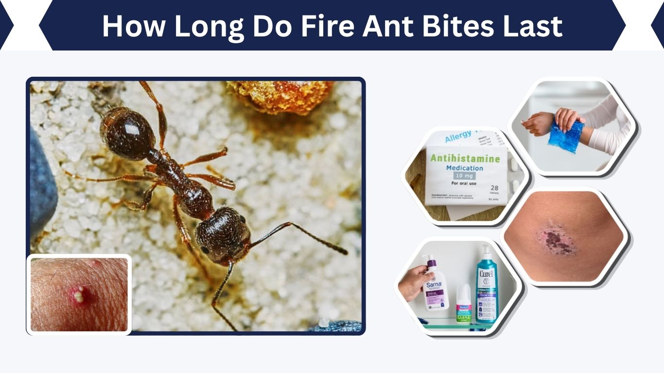 How Long Do Fire Ant Bites Last and How to Heal Faster
