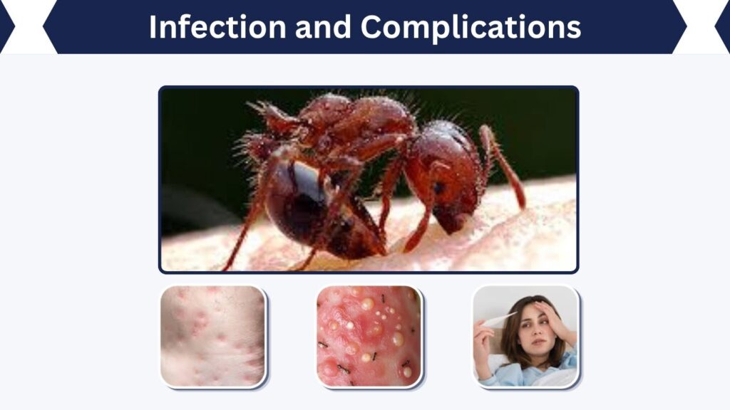 Infection and Complications