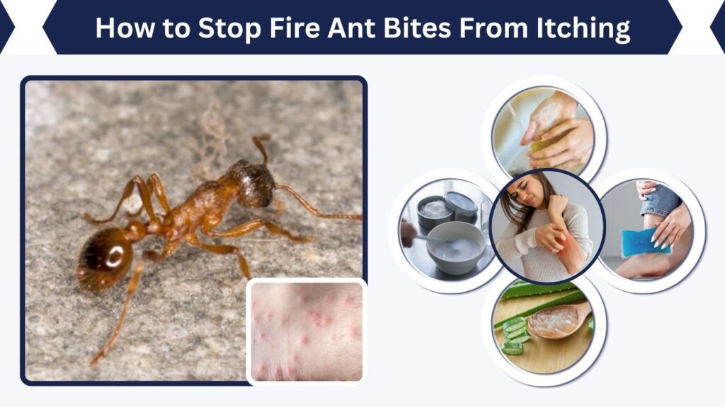 How to Stop Fire Ant Bites From Itching