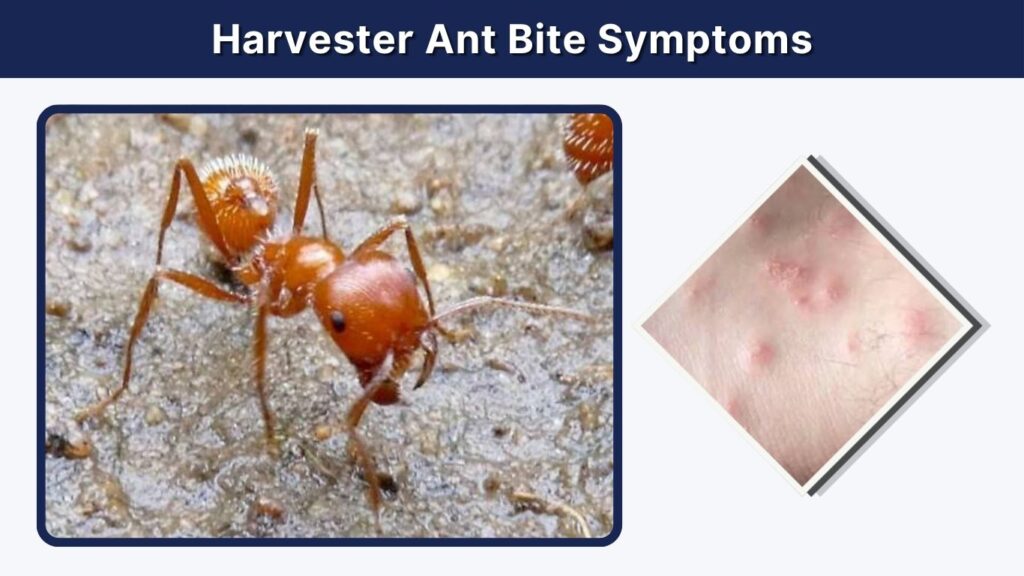 Harvester Ant Bite Symptoms