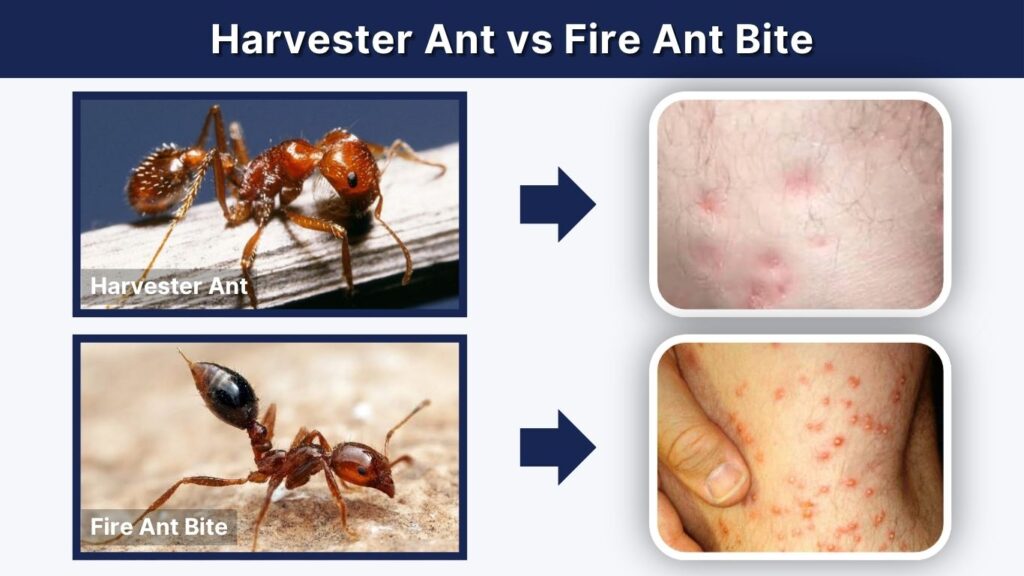 Harvester Ant vs Fire Ant Bite