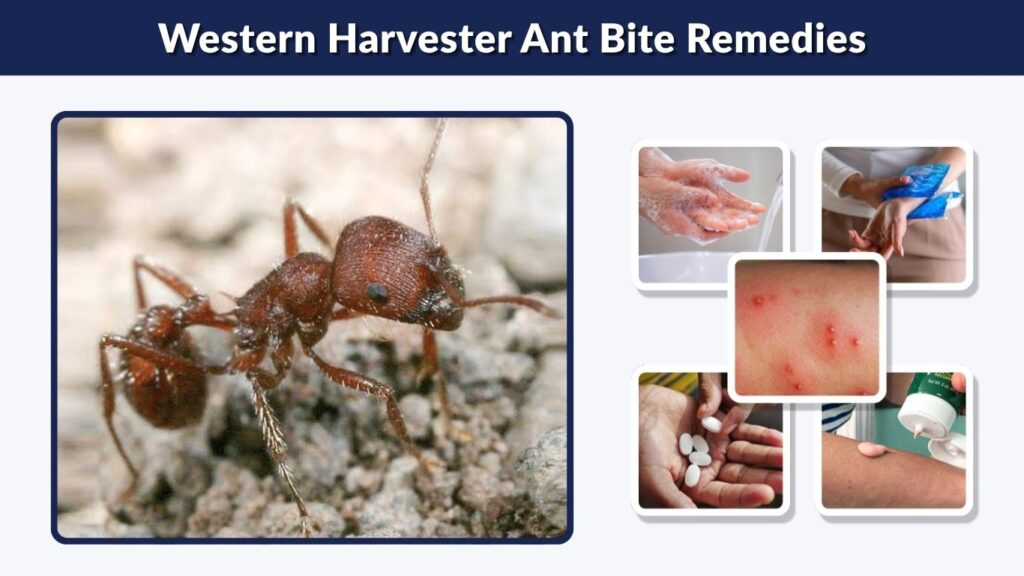 Western Harvester Ant Bite Remedies