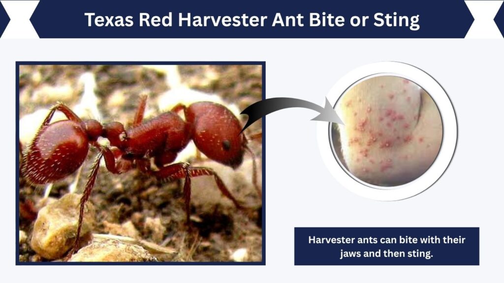 Texas Red Harvester Ant Bite or Sting