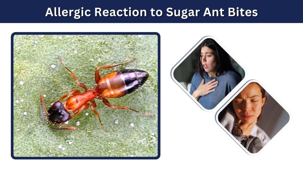 Allergic Reaction to Sugar Ant Bites