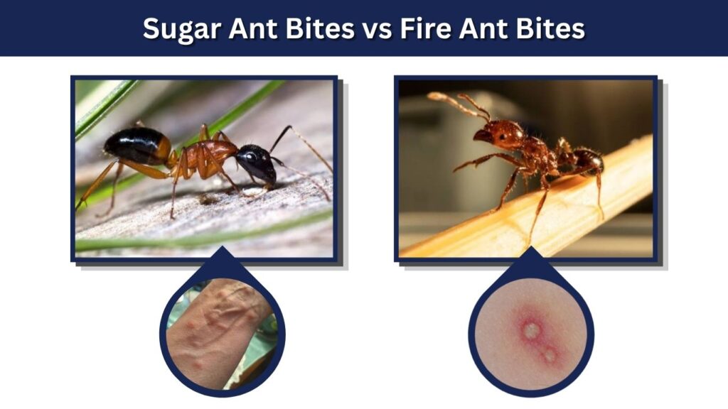 Sugar Ant Bites vs Fire Ant Bites