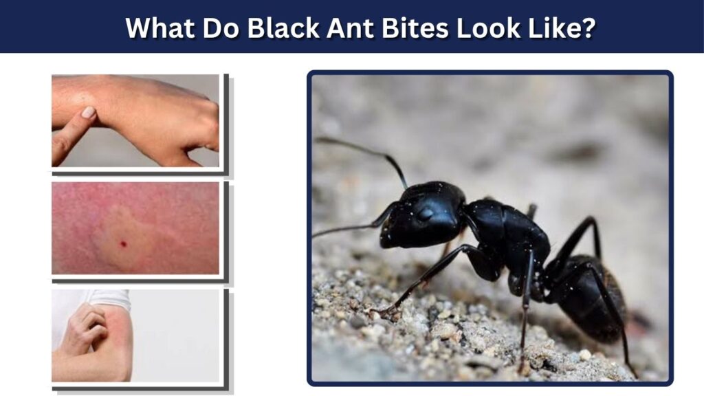 What Do Black Ant Bites Look Like?