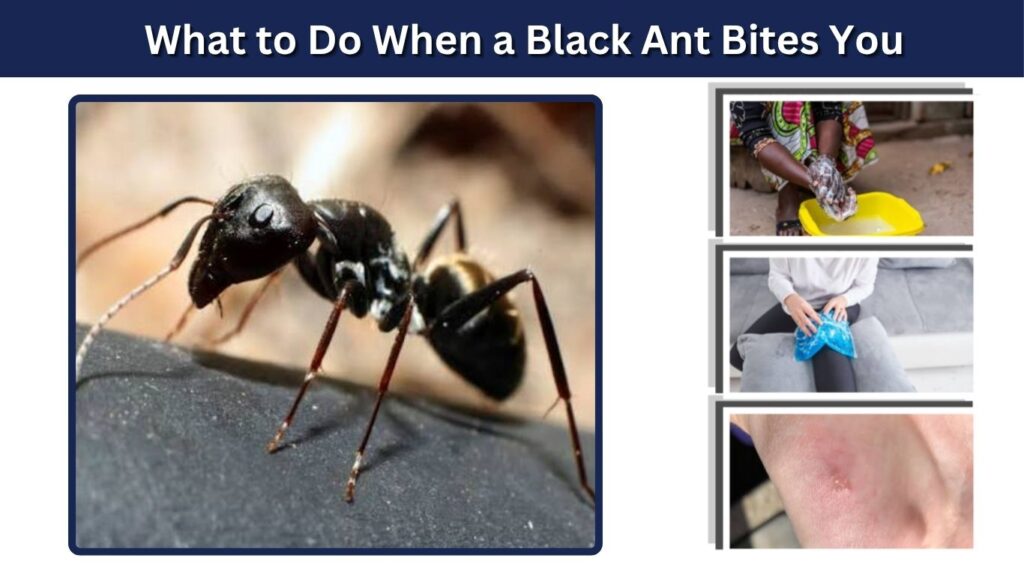 What to Do When a Black Ant Bites You