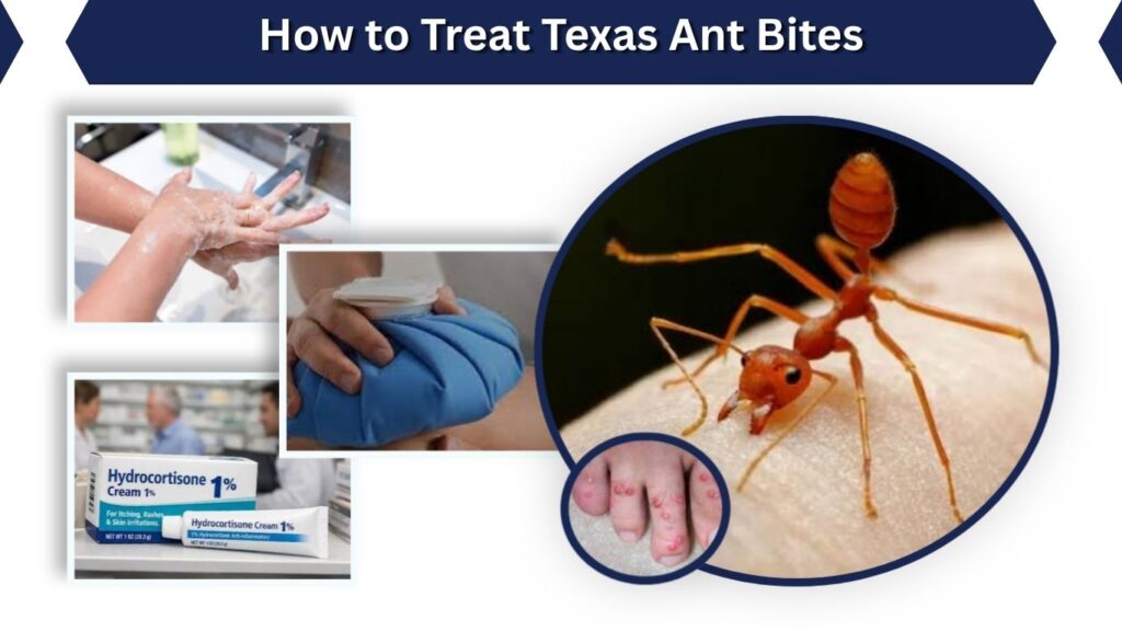 How to Treat Texas Ant Bites