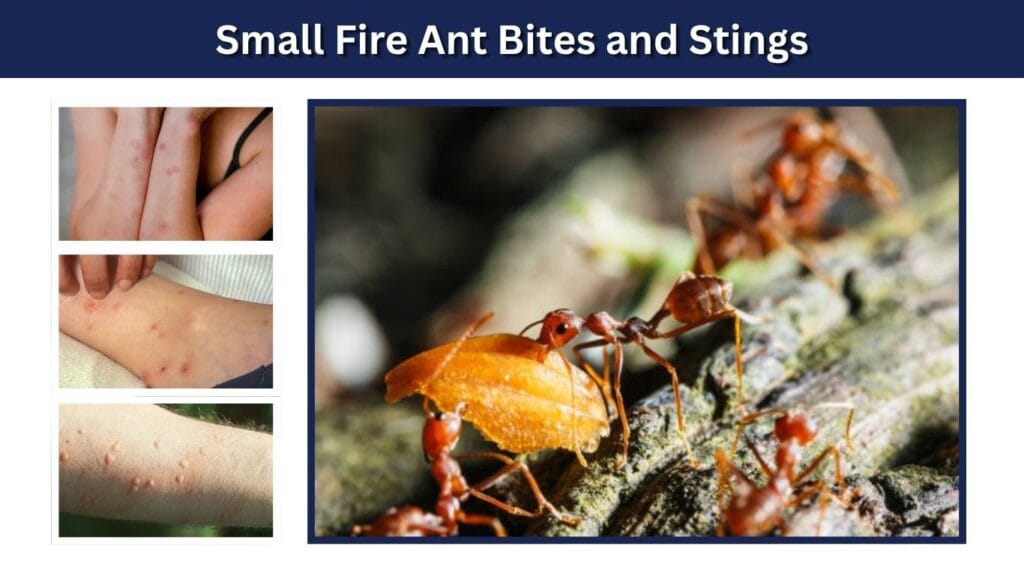 Small Fire Ant Bites and Stings