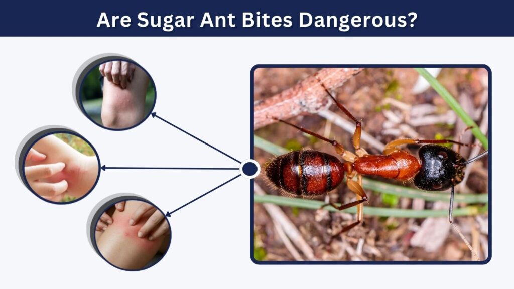 Are Sugar Ant Bites Dangerous?
