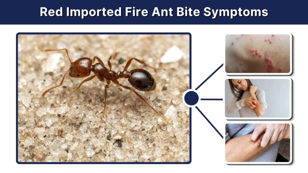 Red Imported Fire Ant Bite Symptoms