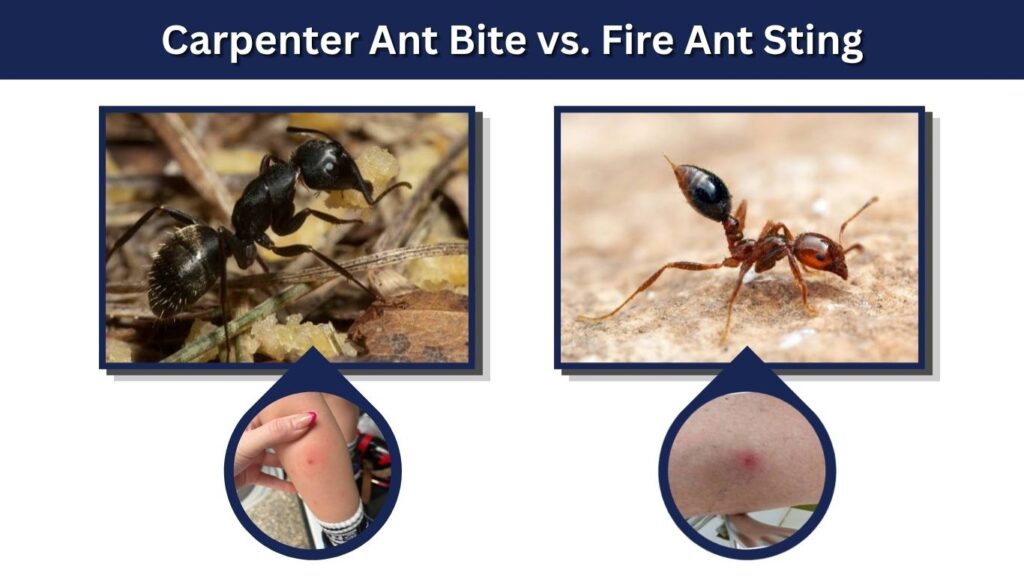 Carpenter Ant Bite vs. Fire Ant Sting